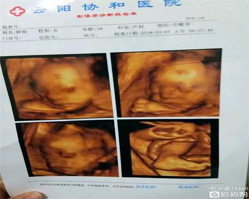 武汉代孕妈妈_武汉代孕网站_兰州女性宫外孕后只