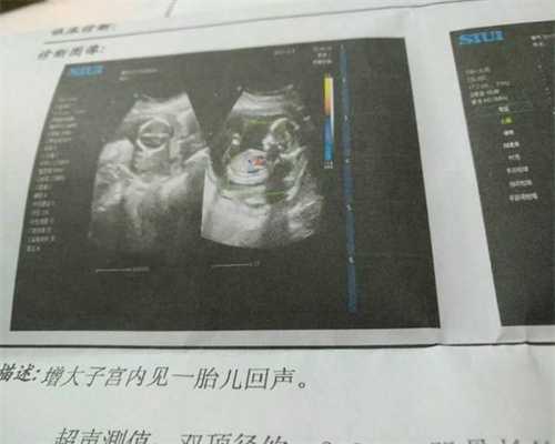 武汉代孕中心官方网站_武汉代孕怀双胞胎多少钱